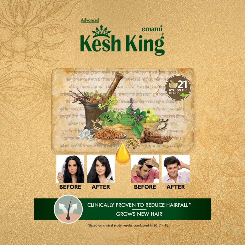 Kesh King Oil 100ml+ Shampoo Conditioner Combo 200ml - Image 3